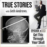 True Stories #333 - Get This Through Your Skull