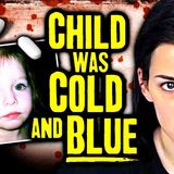 2 Year Old Overdoses On Oxycodone Shrinking Her Eyes