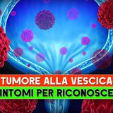 Tumore Alla Vescica: I 5 Sintomi Per Riconoscerlo!