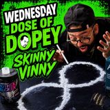 Shooting Liquid LSD, Living in a Porta Potty, Smuggling Heroin in Jail & Steve-O’s Wild Ride, Divorce, losing 200 pounds Skinny Vinny
