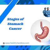 Exploring the Different Stages of Stomach Cancer