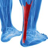 Expert Care for Achilles Tendonitis in Houston Today