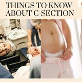 Things to know about C-Section