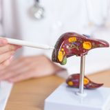Es Salud: Hígado y riñón, la salud que va de la mano