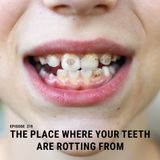 Ep. 219: The Place Where Your Teeth Are Rotting From