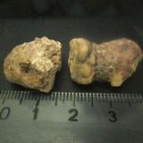 Survival Medicine Hours: Bacterial Infections, Stones, Antibiotics