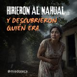 Un Pájaro Con Rostro Humano La Atacaba Todos Los Días | 2969 07