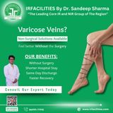 Vein Solutions: Exploring Laser Treatment for Varicose Veins