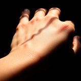 Pelle fragile su mani e gambe? Come HEVOLVISKIN ripristina la struttura e la forza della pelle sottile con dermatoporosi