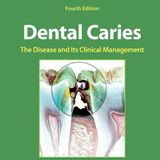 Dental Caries: The Disease and Its Clinical Management