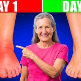 15 Years of Swollen Legs _ Feet GONE in Minutes _ Do THIS for Fast Relief_ _ Barbara O_Neil