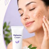 Melasma Creams A Simple Guide to Even-Toned Skin  Online Generic Medicine