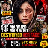 She Married The Man Who Destroyed Her Face