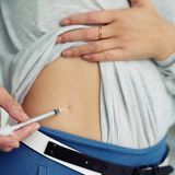 Best Injection Sites for Mounjaro & Other Weight Loss Medications: Tips for Comfort & Effective
