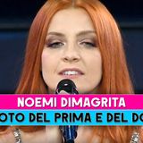 Noemi Dimagrita: Le Foto Del Prima E Del Dopo!