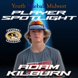 Player Spotlight | Oakville: Adam Killburn | YBMcast