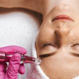 Dr Pen Worldwide: The Future of At-Home Microneedling