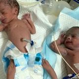 Woman At Age 74 Gives Birth To Twin Girls