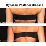 Health Check: How To Nonsurgically Get Rid of Bra Line Fat with Kybella® Fat Melting Injections