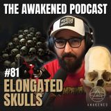 Elongated Skulls: Red-Haired Urukehu & Allegewi Giants, Nephilim, The Path of Viracocha, Phonecians, Atlantis, & Serpent Mound w/ Doc Brown