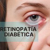 Dr. Santiago Coloma Romero: Retinopatía Diabética