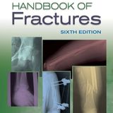 Handbook of Fractures