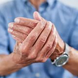 Benefits of Physical Therapy for Arthritis Management