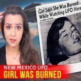 Her Eyes were BURNED by this UFO