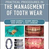 Practical Procedures in the Management of Tooth Wear
