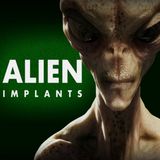 Alien implants - Fact or fiction? With Steven Colbern