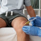 How Stem Cell Injections Heal Arthritis Over Six Months