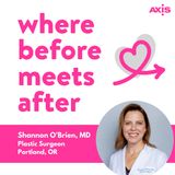 The peel that does what lasers can’t [Shannon O'Brien, MD, Portland]