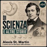 Di scienza e altre storie #04 | L'uomo con un vero buco nello stomaco!