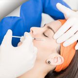 #58 Patas de Gallo: Cómo Eliminarlas con Tratamientos Profesionales de Medicina Estética