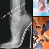 Let's talk about feet and heels. Part 2.