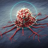 Virtual Oncology