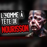 L'Homme à Tête de Bébé : la créature qui glace le sang