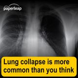 Lung collapse is more common than you think