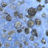 Pioneering cancer plasticity atlas will help predict response to cancer therapies