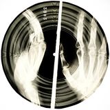 Bone Music: quando la musica proibita viaggiava sulle radiografie sovietiche
