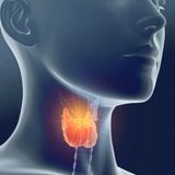 Signs and Symptoms of Hypothyroidism