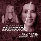 El dolor emocional fue más fuerte que el de mis quemaduras - Episodio 205