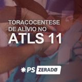 Toracocentese de alívio: o que mudou no ATLS?