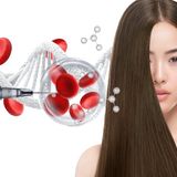 Is Stem Cell Hair Treatment the Future of Hair Restoration? Here’s the Truth