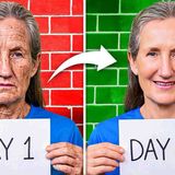 Seniors SHOCKED_ ERASE Age Spots Overnight _ Look DECADES Younger_ _ Barbara O_Neill