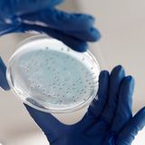 Proteggere il paziente, preservare il futuro: il contributo infermieristico alla lotta contro l'antibiotico resistenza