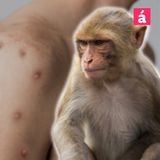 ¿Qué tan contagiosa es la viruela del mono?