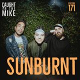 SUNBURNT