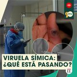 Mpox: ¿Qué ha pasado con las vacunas? ¿Cuál es la situación en Colombia? Le contamos.