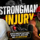 Strongman Injury: Quad & Kneecap Ruptures, Blood Clots, Infection, and Leg Amputation